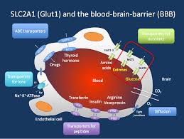 What is Glut 1 deficiency?